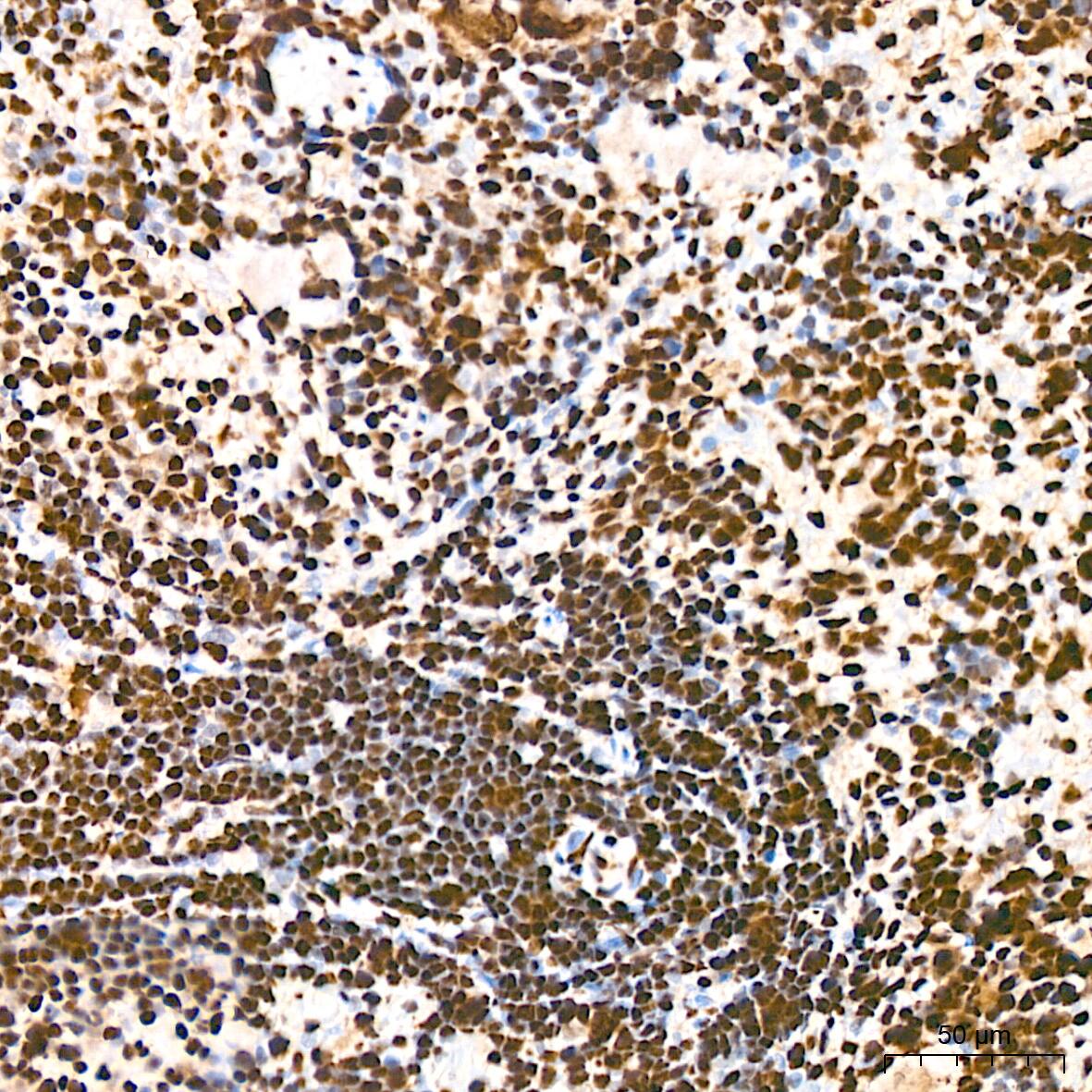 hnRNP K Antibody (3O5Y4)