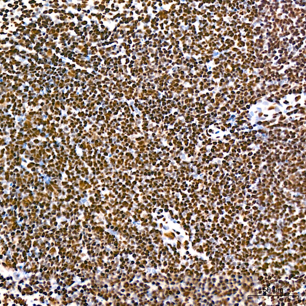 hnRNP K Antibody (3O5Y4)