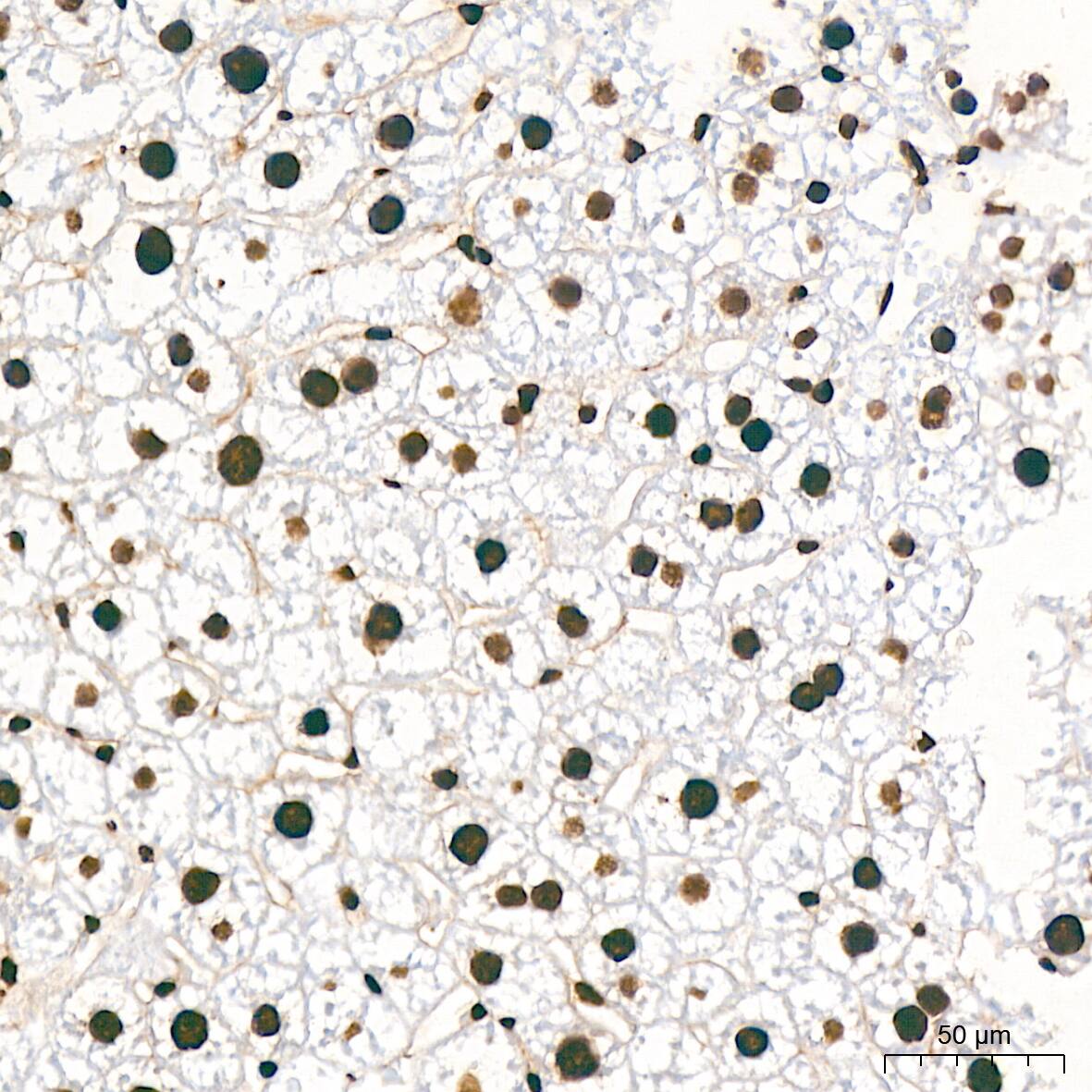 hnRNP K Antibody (3O5Y4)