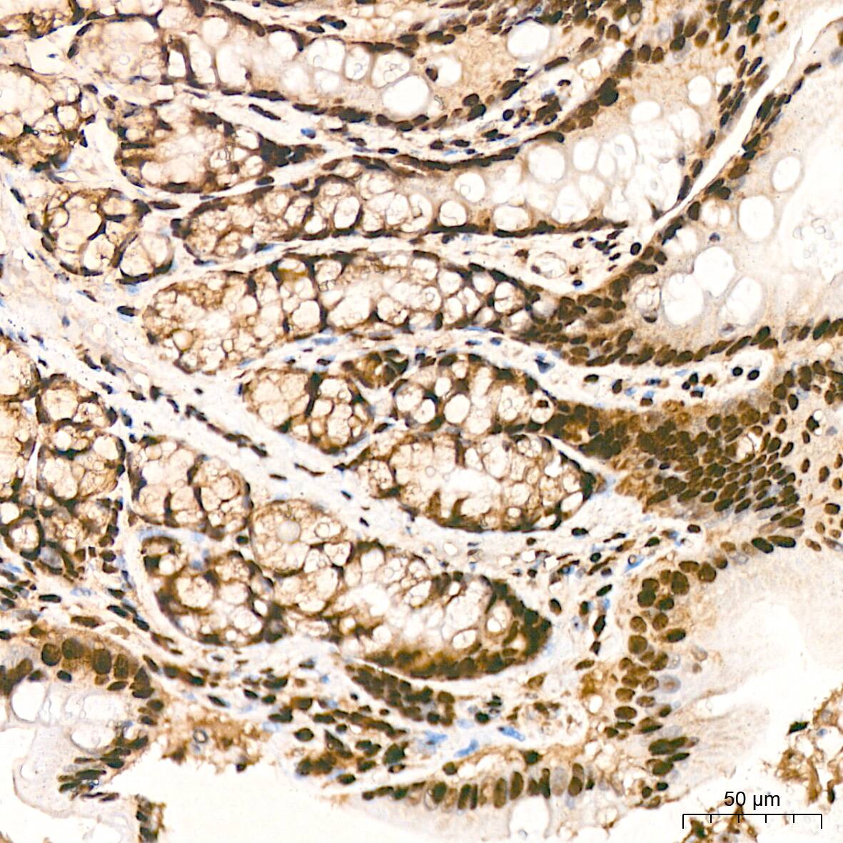 hnRNP K Antibody (3O5Y4)