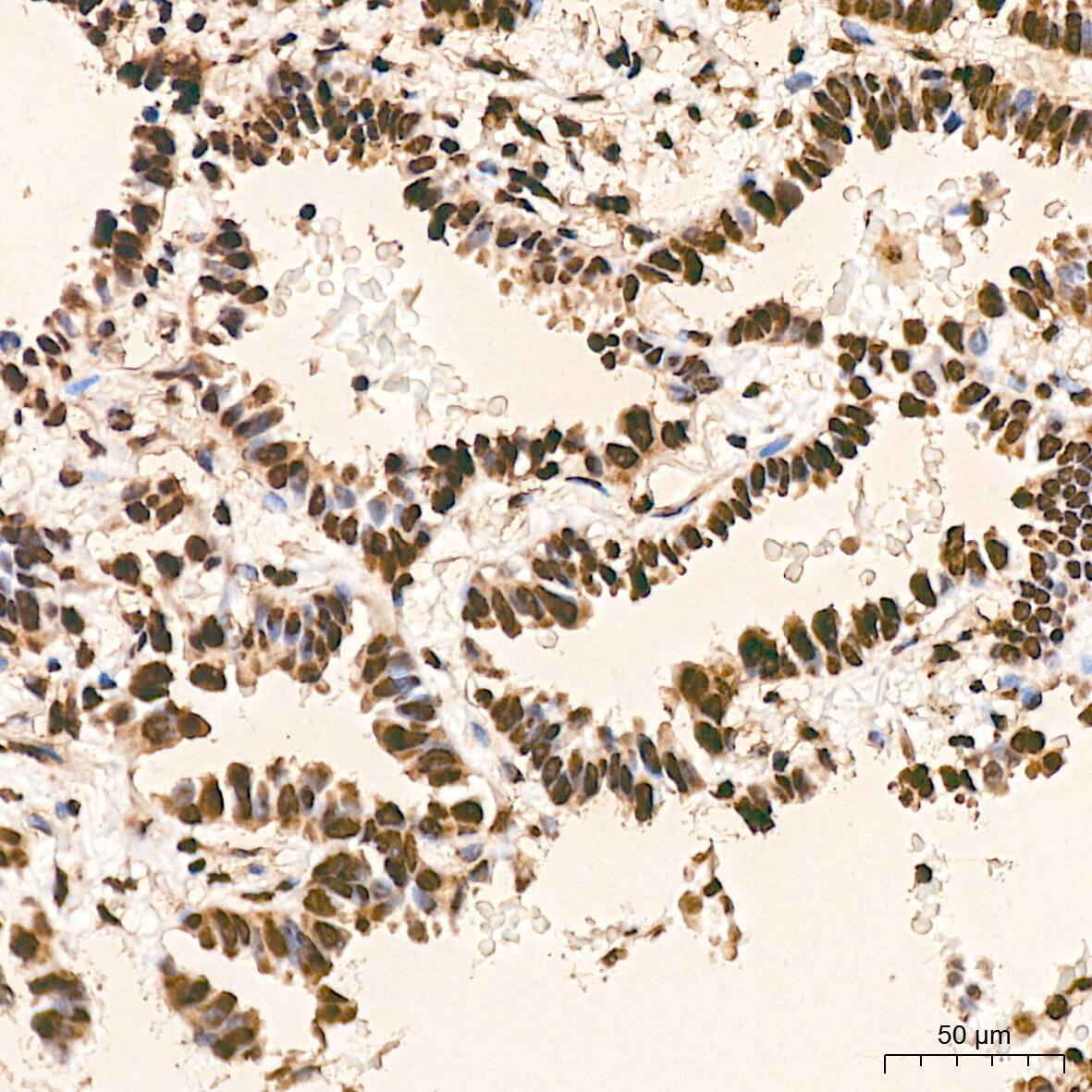 hnRNP K Antibody (3O5Y4)
