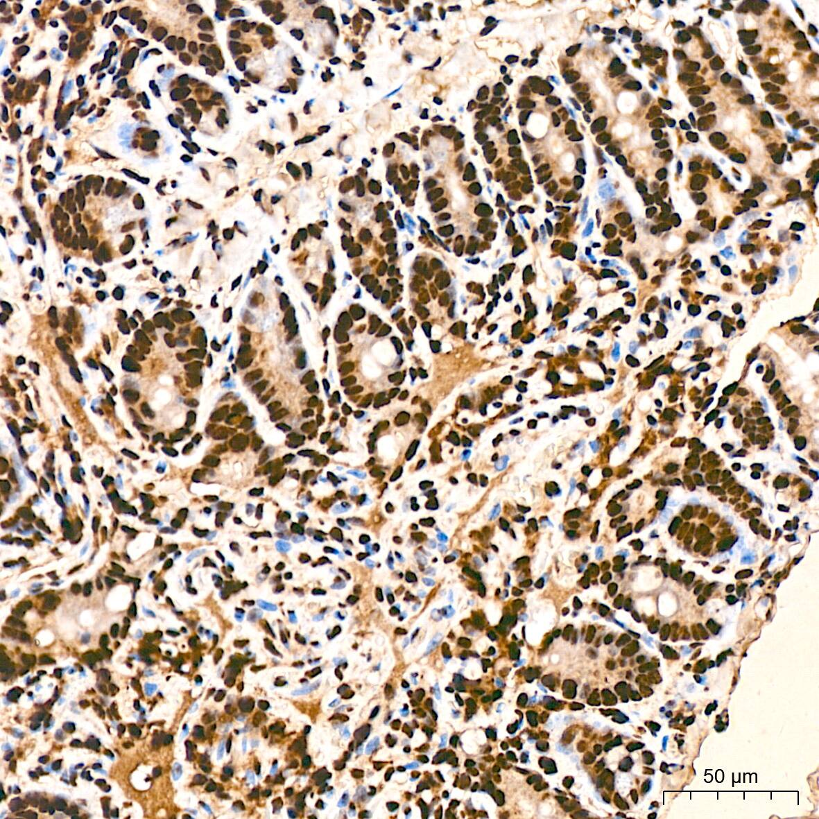 hnRNP K Antibody (3O5Y4)