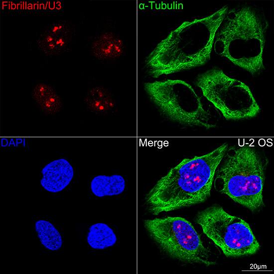 Fibrillarin Antibody (9J5O2)