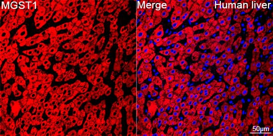 Microsomal Glutathione S-transferase 1 Antibody (6A0S5)