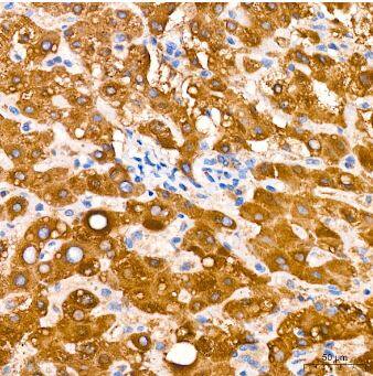 Microsomal Glutathione S-transferase 1 Antibody (6A0S5)