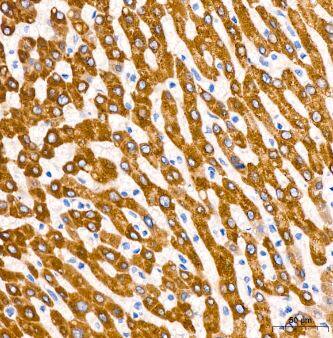 Microsomal Glutathione S-transferase 1 Antibody (6A0S5)