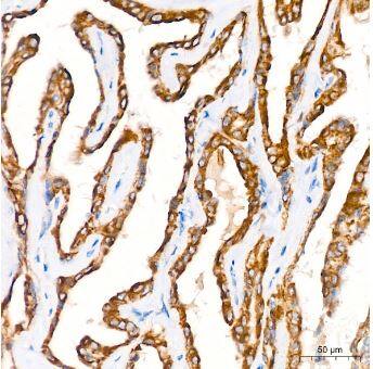 Microsomal Glutathione S-transferase 1 Antibody (6A0S5)