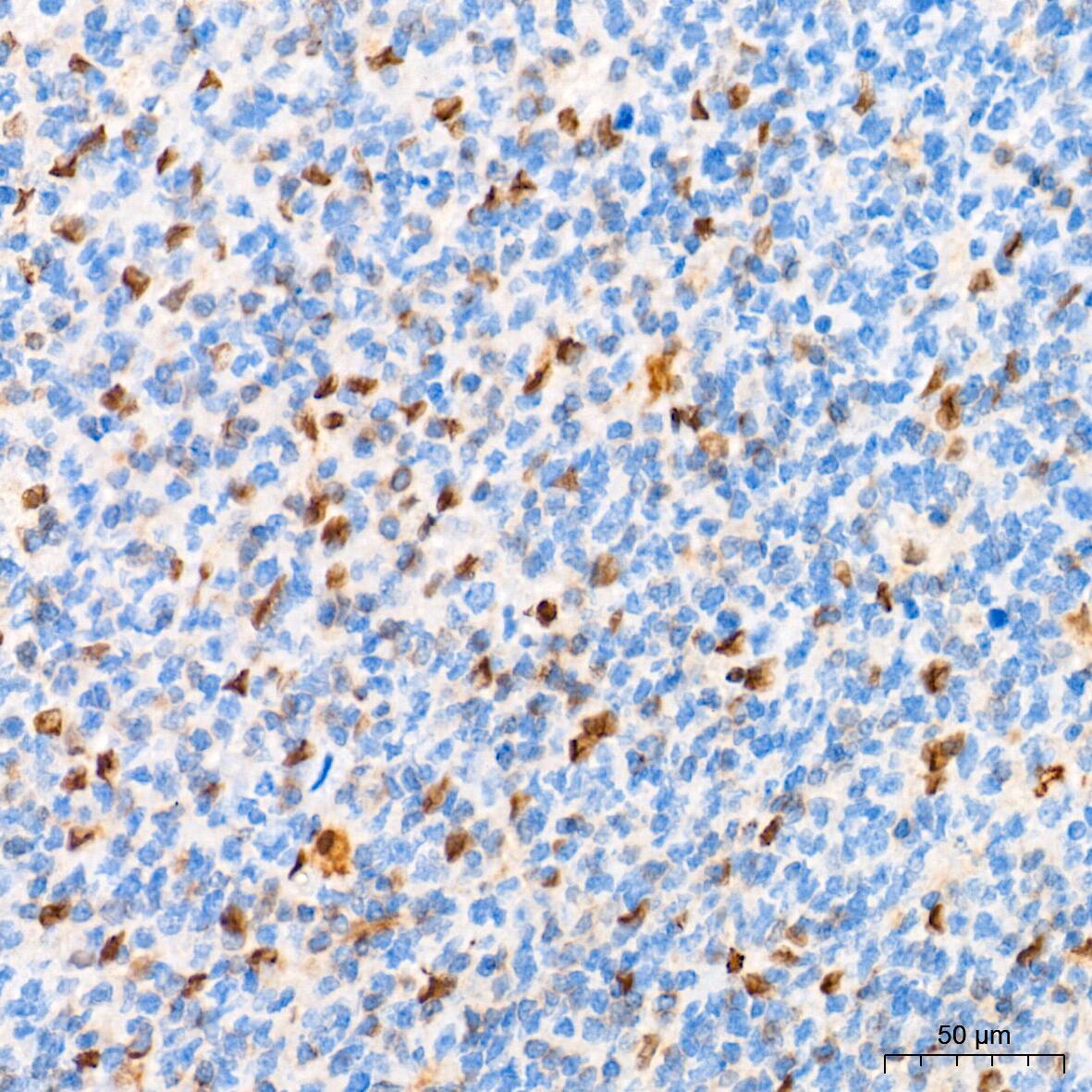 HES-1 Antibody (9I2E8)