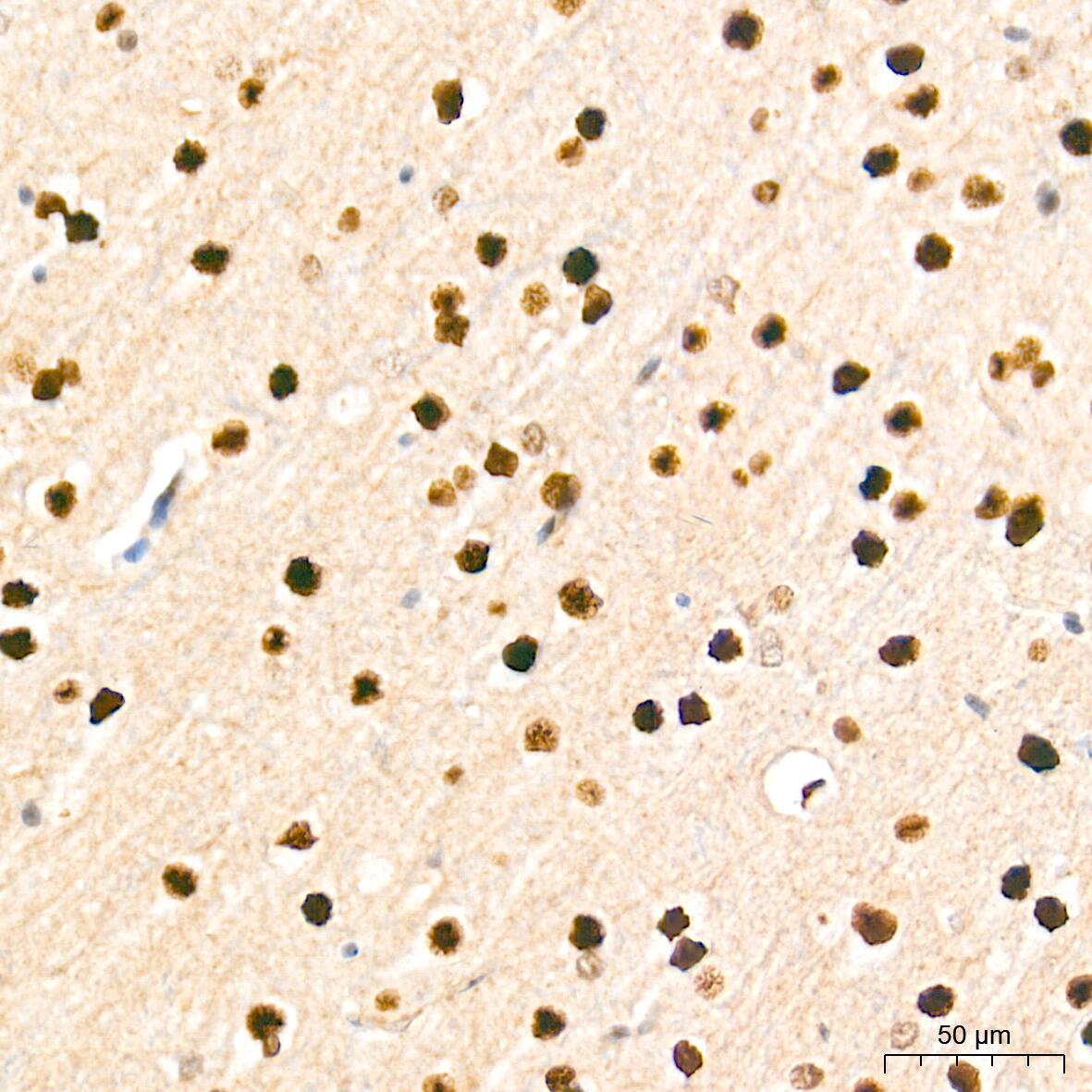 HES-1 Antibody (9I2E8)