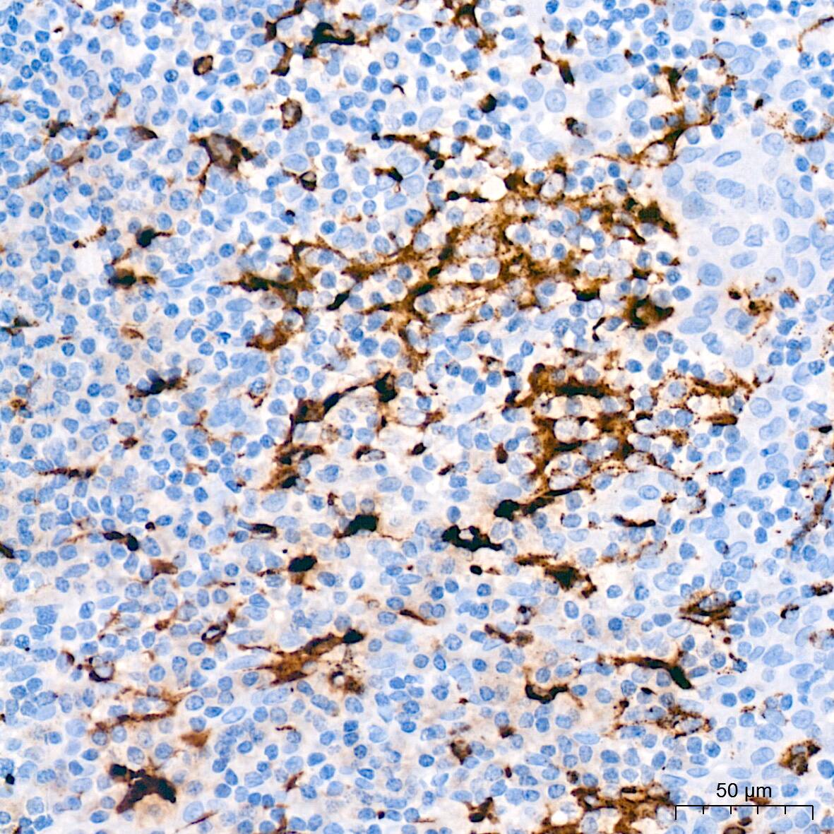 Lysozyme Antibody (2Y5E4)