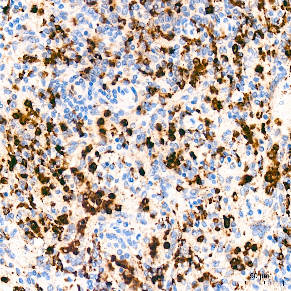 Lysozyme Antibody (2Y5E4)