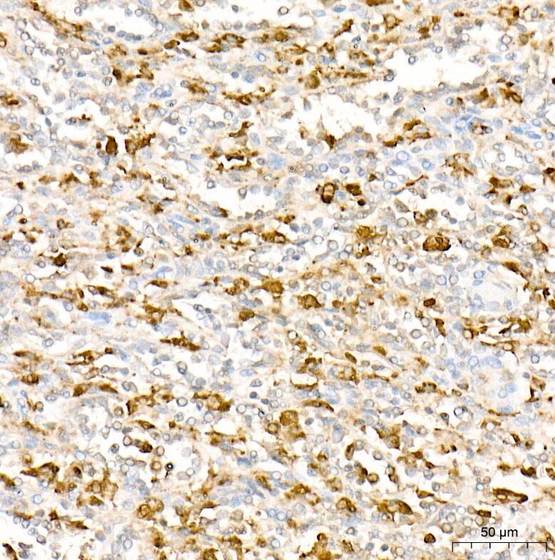 Lysozyme Antibody (ARQ4974)