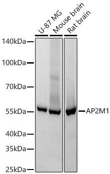 AP2M1 Antibody (10J8D1)