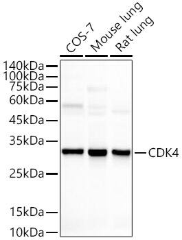 CDK4 Antibody (6N3M6)