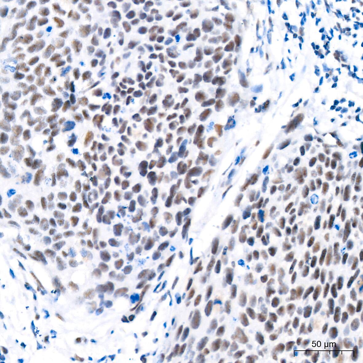 CDK4 Antibody (6N3M6)