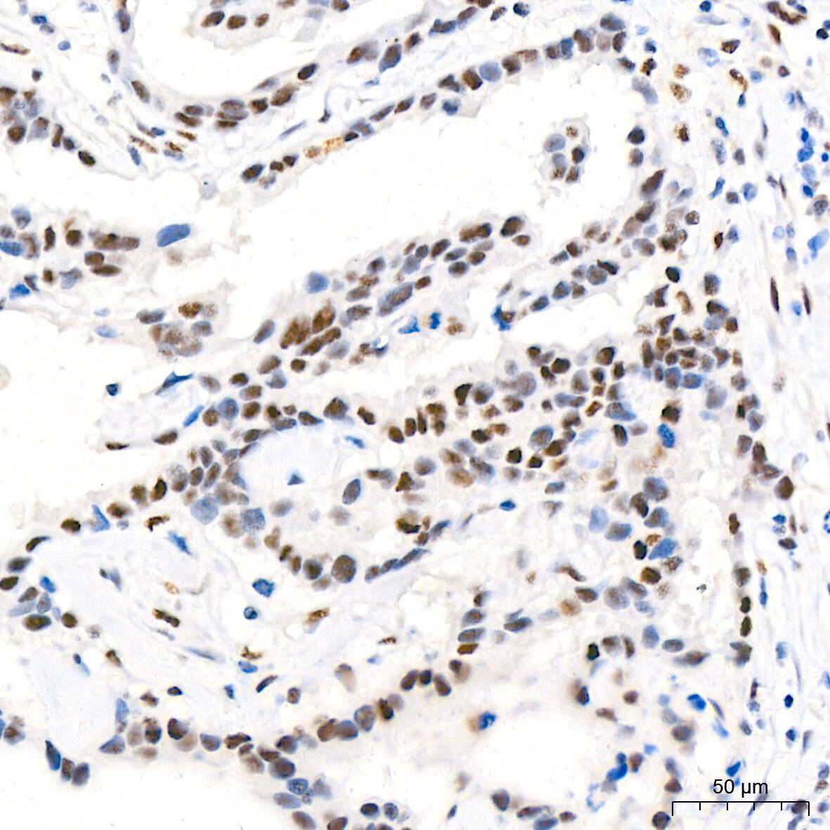 CDK4 Antibody (6N3M6)
