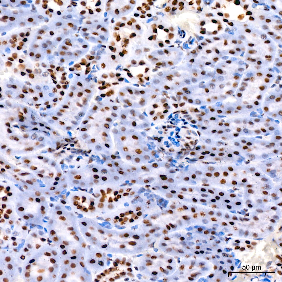 Cdk9 Antibody (1C4E3)