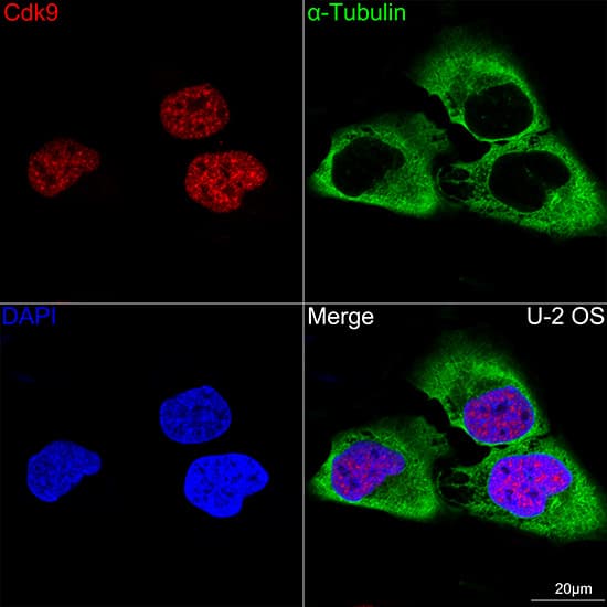 Cdk9 Antibody (1C4E3)