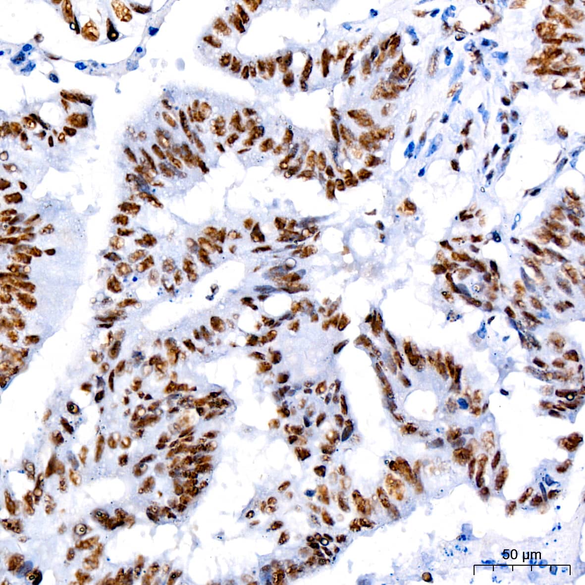 Cdk9 Antibody (1C4E3)