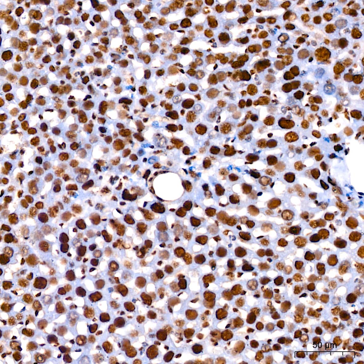 Cdk9 Antibody (1C4E3)
