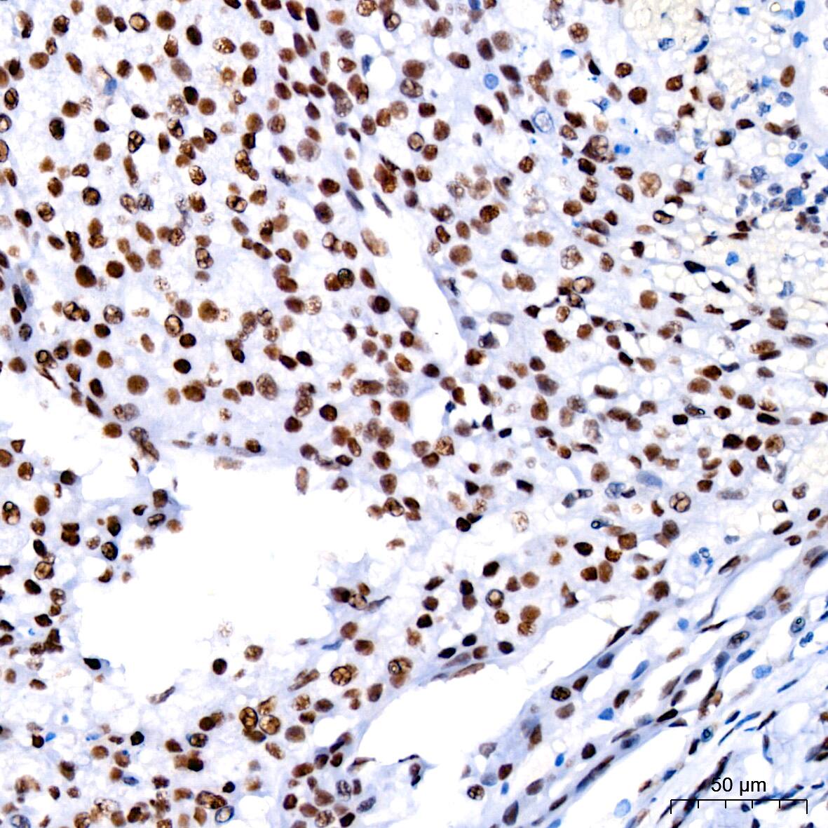 Cdk9 Antibody (1C4E3)