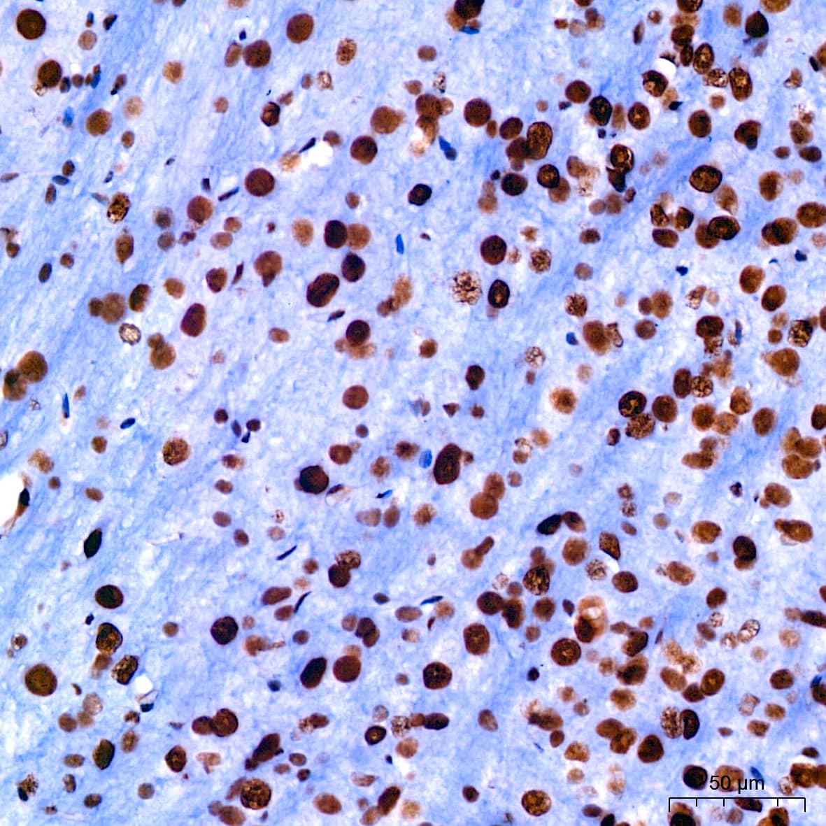 Cdk9 Antibody (1C4E3)
