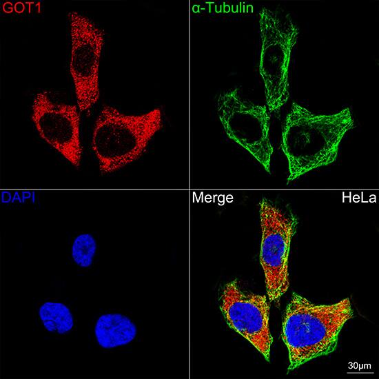 Aspartate Aminotransferase Antibody (5J1B4)