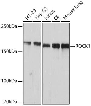 ROCK1 Antibody (H5E4)