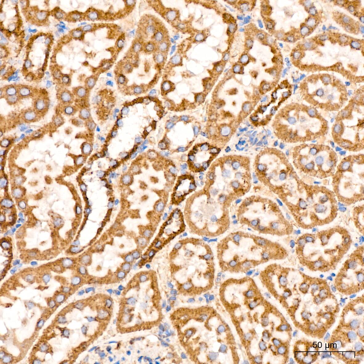 ATPB Antibody (1H2W2)
