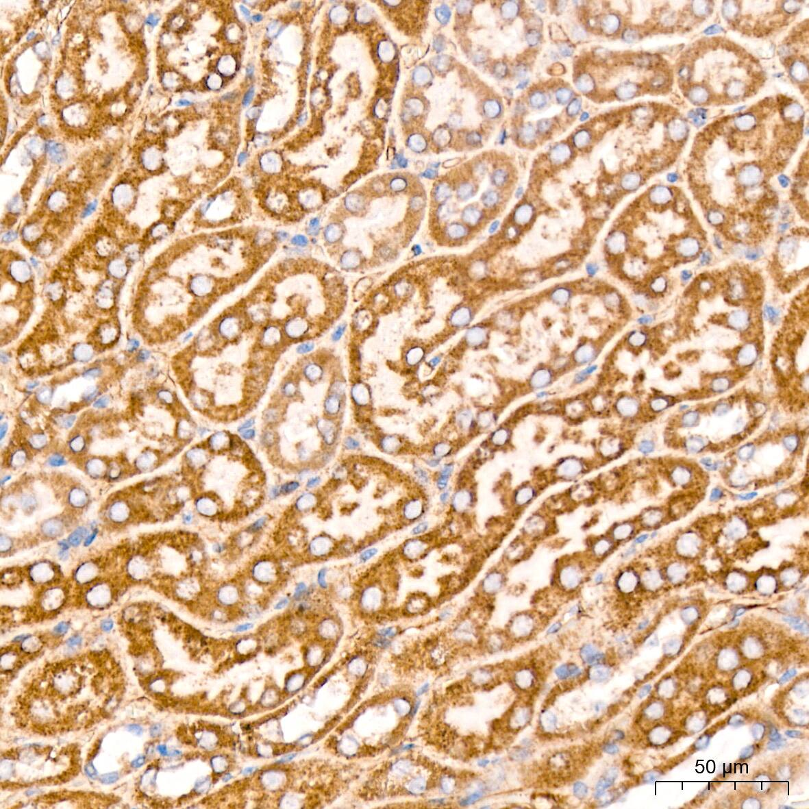 ATPB Antibody (1H2W2)