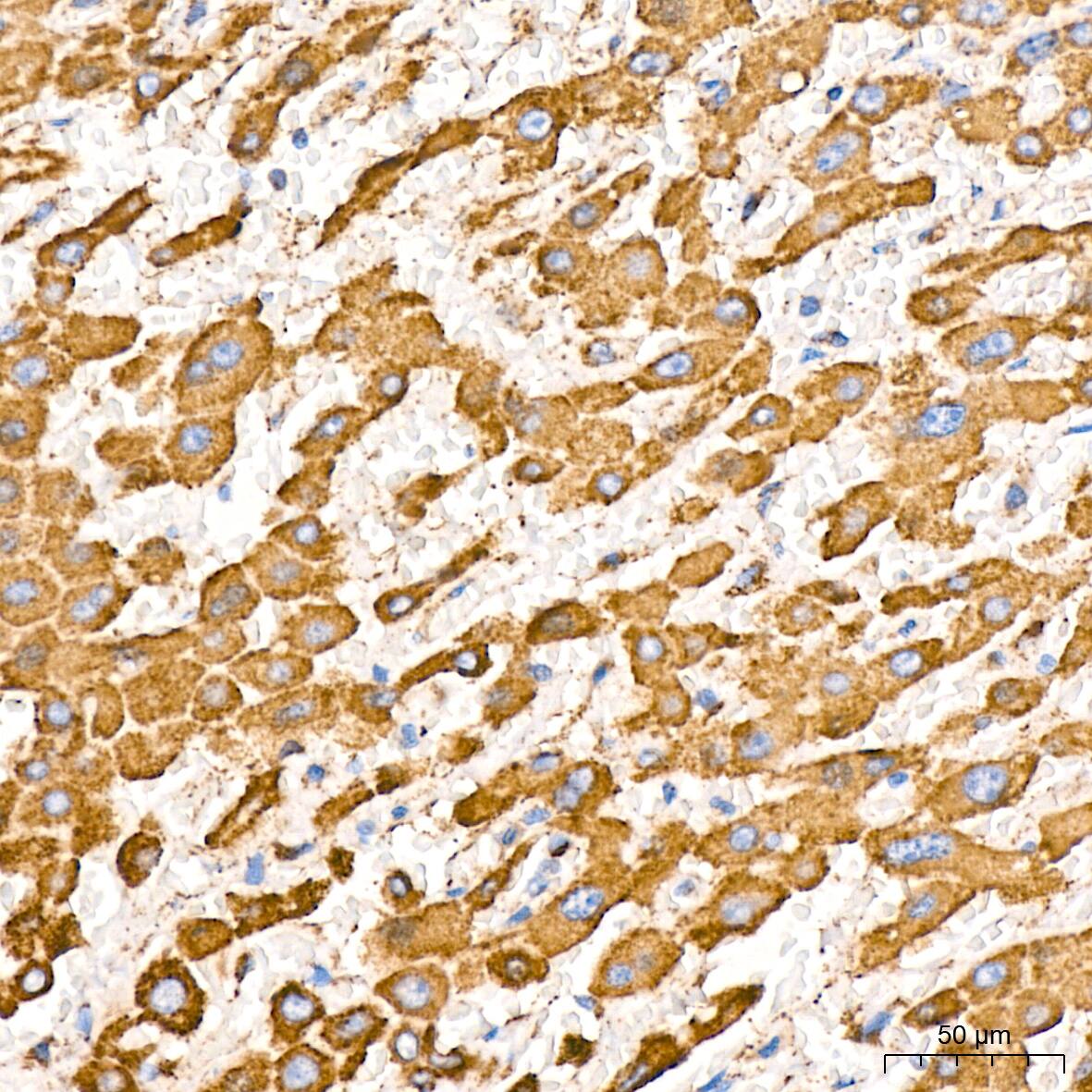 ATPB Antibody (1H2W2)