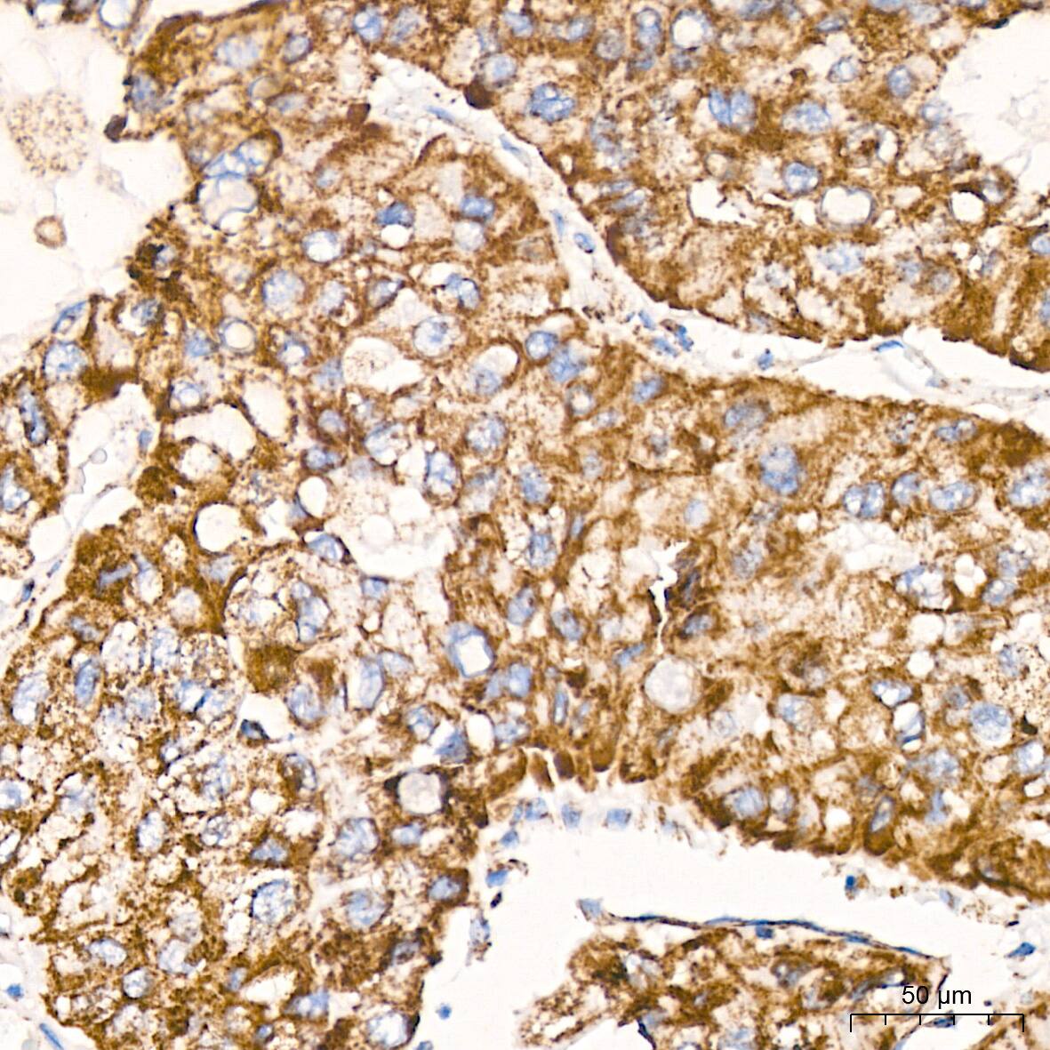 ATPB Antibody (1H2W2)