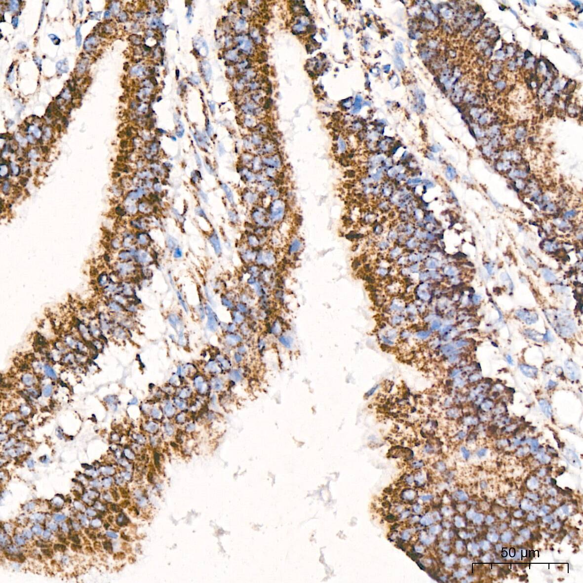 ATPB Antibody (1H2W2)
