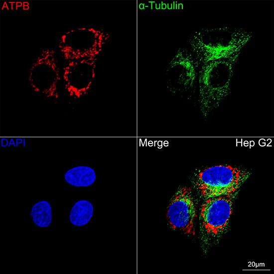 ATPB Antibody (1H2W2)