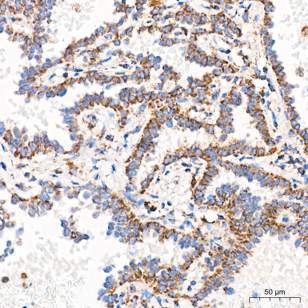 ATPB Antibody (1H2W2)