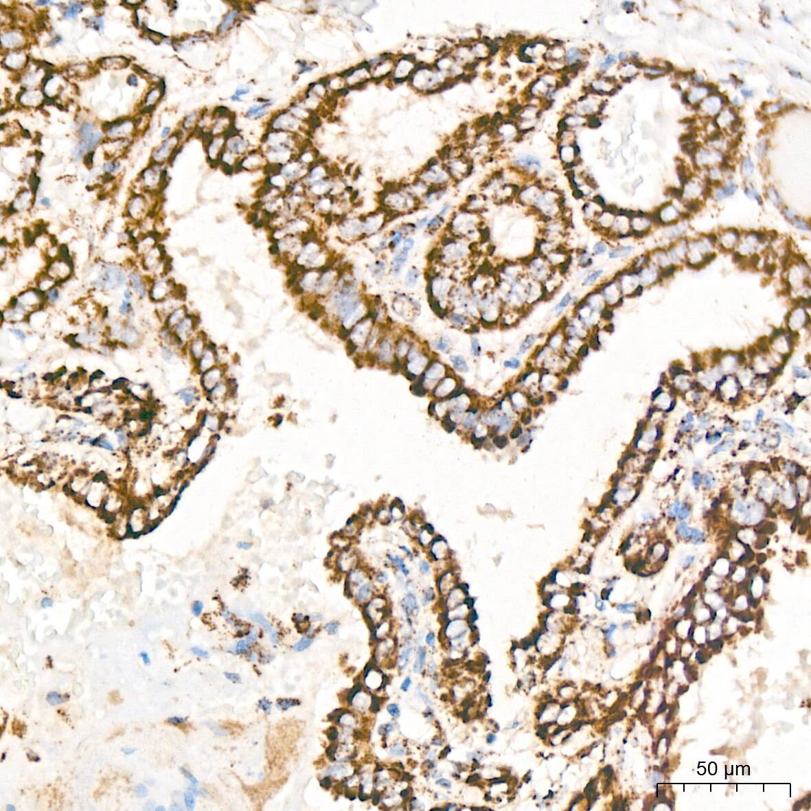 ATPB Antibody (1H2W2)