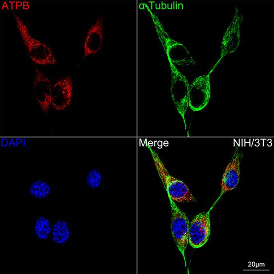 ATPB Antibody (1H2W2)