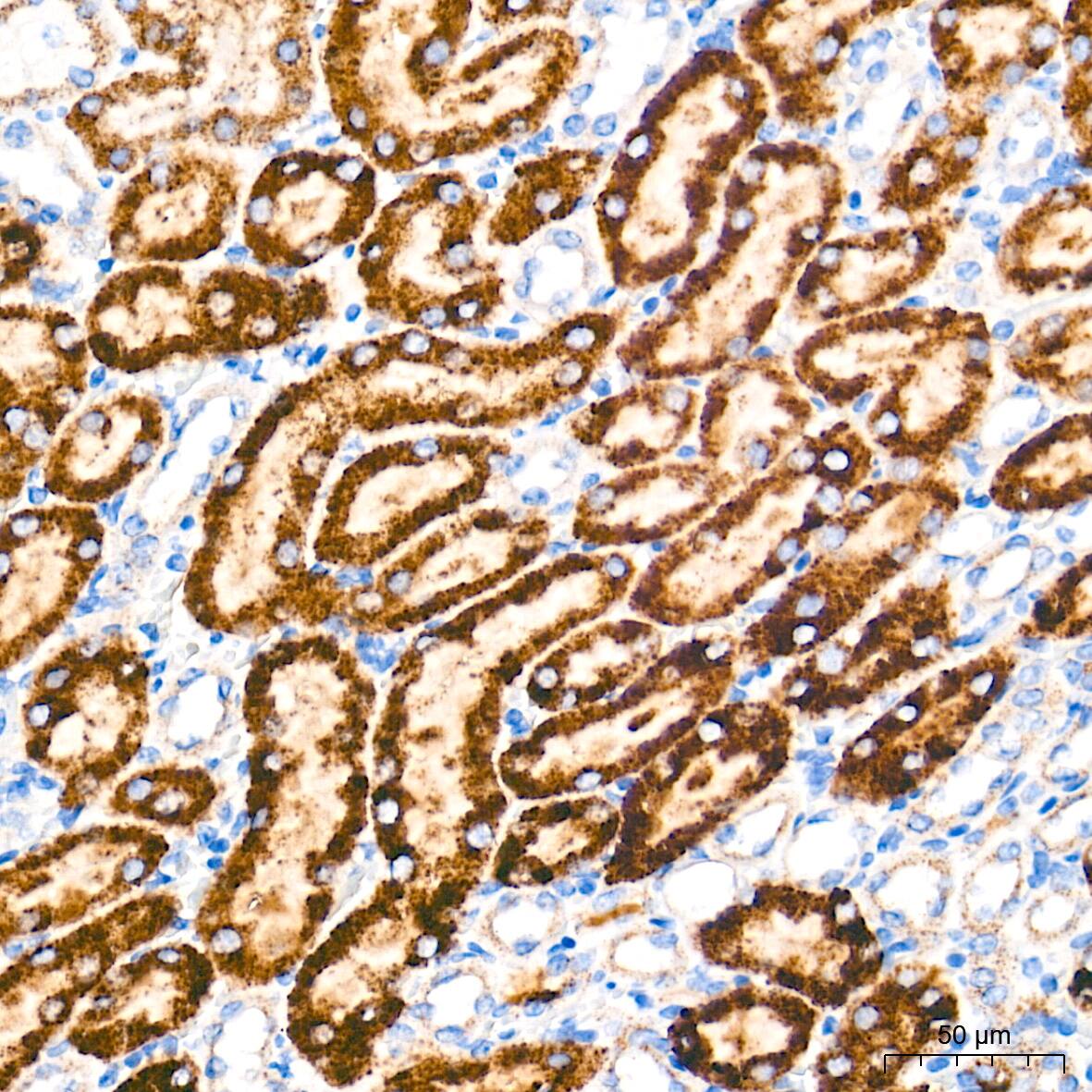Catalase Antibody (7D2Y4)