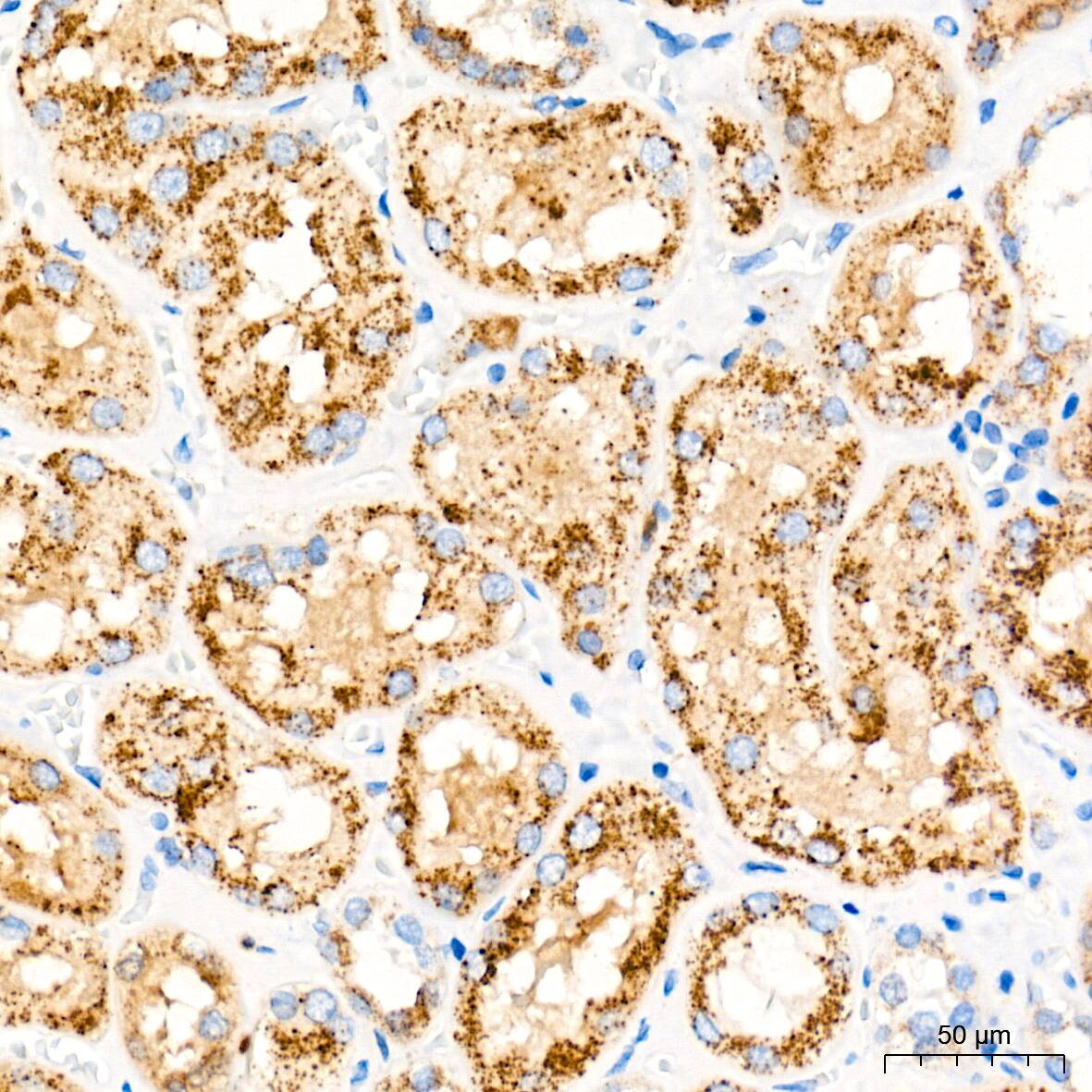 Catalase Antibody (7D2Y4)