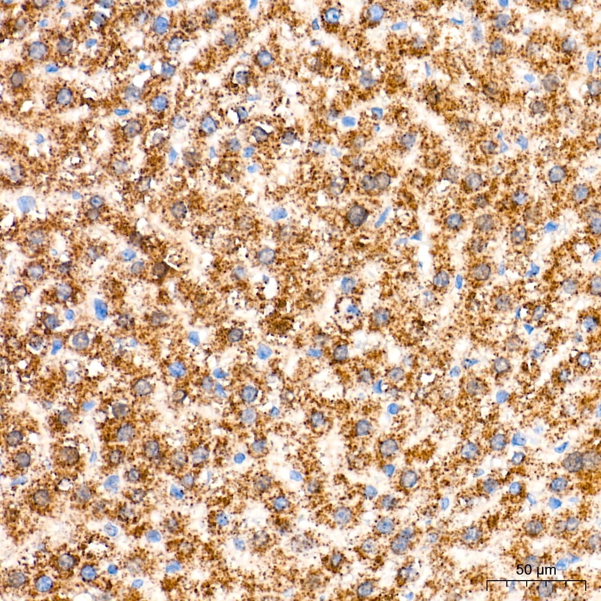 Catalase Antibody (7D2Y4)