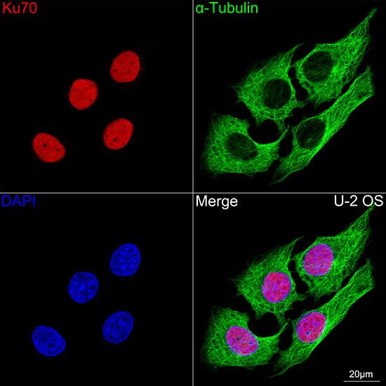 Ku70/XRCC6 Antibody (8L6B6)