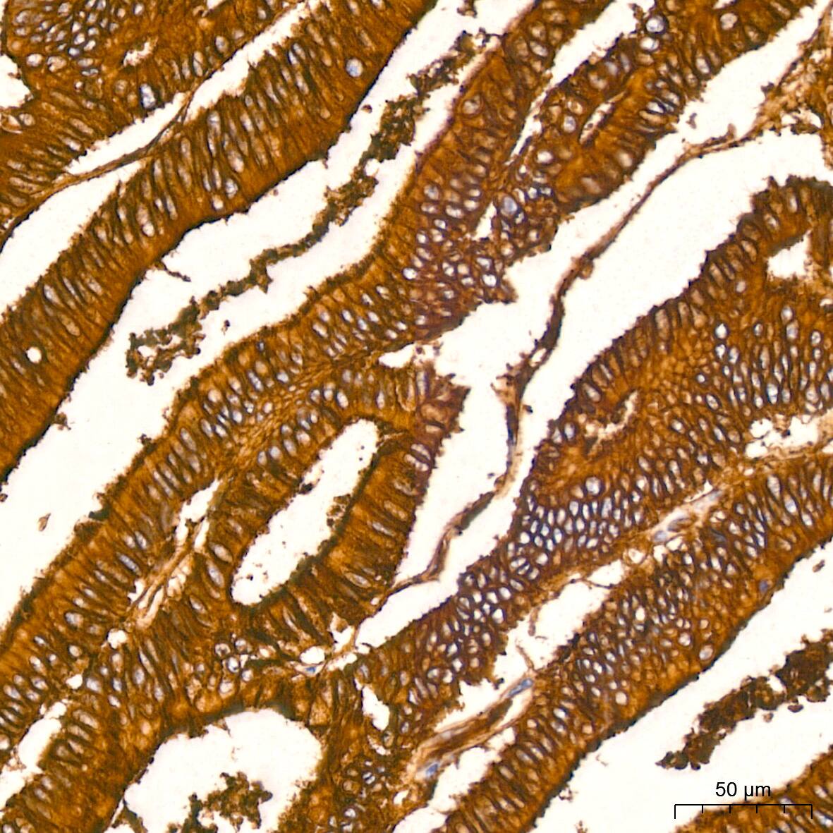 Annexin A2 Antibody (1W2B5)