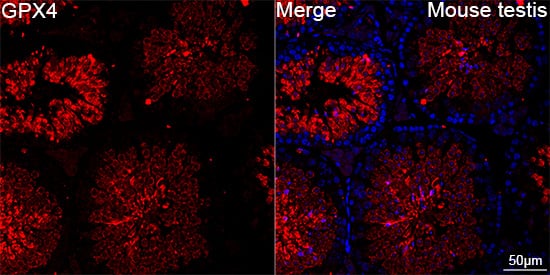 Glutathione Peroxidase 4/GPX4 Antibody (7O4Q9)