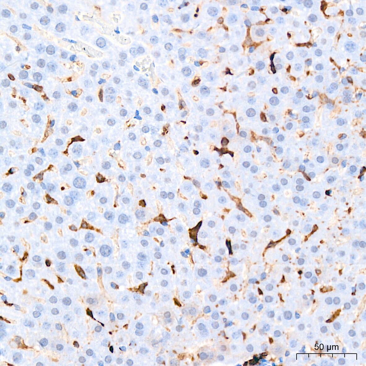 HLA DQA1 Antibody (7W0M7)