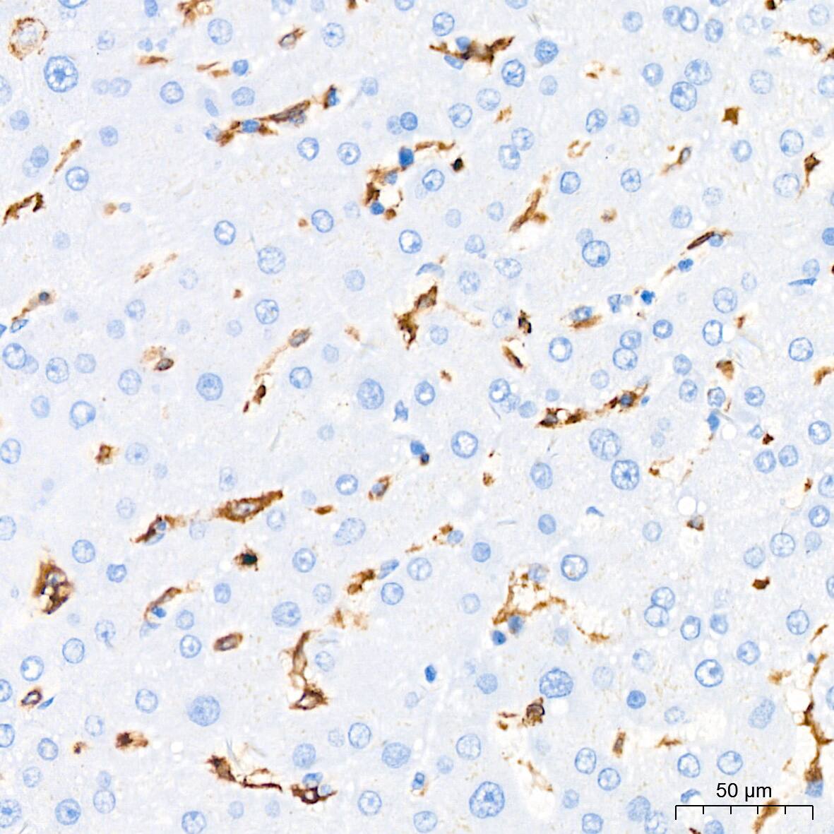 HLA DQA1 Antibody (7W0M7)