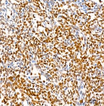 FGF basic/FGF2/bFGF Antibody (8W6M5)