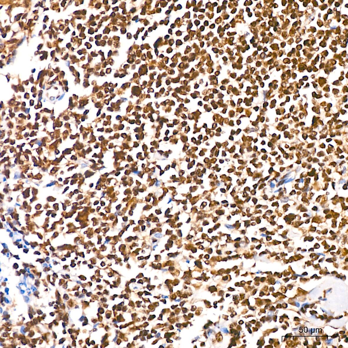 DDX5 Antibody (1K6X10)