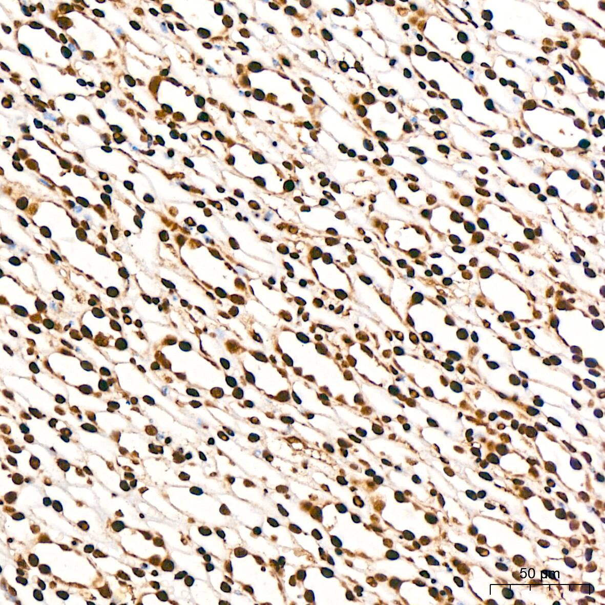 DDX5 Antibody (1K6X10)