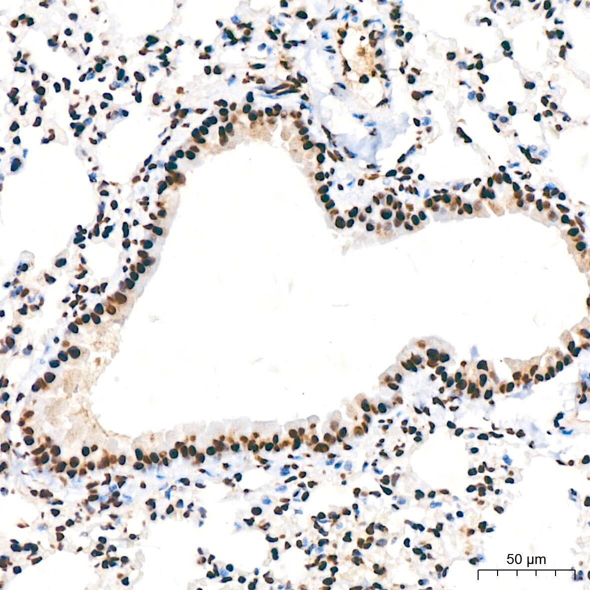 DDX5 Antibody (1K6X10)