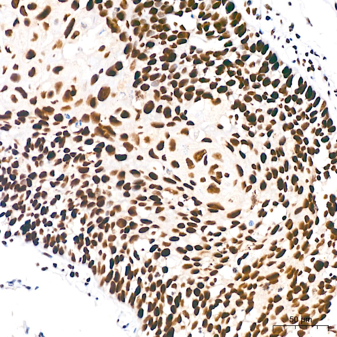 DDX5 Antibody (1K6X10)